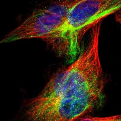 Immunocytochemistry/Immunofluorescence: ITFG1 Antibody [NBP1-85734] - Immunofluorescent staining of human cell line U-251 MG shows localization to intermediate filaments & aggresome.