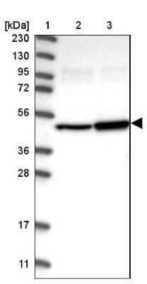 Western Blot: ITFG1 Antibody [NBP1-85734] - Lane 1: Marker  [kDa] 230, 130, 95, 72, 56, 36, 28, 17, 11.  Lane 2: Human cell line RT-4.  Lane 3: Human cell line U-251MG sp