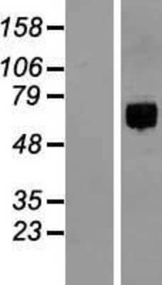 Western Blot: ITFG1 Overexpression Lysate (Adult Normal) [NBL1-12058] Left-Empty vector transfected control cell lysate (HEK293 cell lysate); Right -Over-expression Lysate for ITFG1.