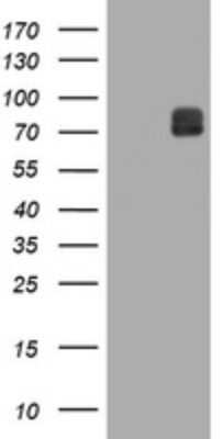 Western Blot: ITFG3 Antibody (OTI3B3) - Azide and BSA Free [NBP2-72253] - Analysis of HEK293T cells were transfected with the pCMV6-ENTRY control (Left lane) or pCMV6-ENTRY ITFG .