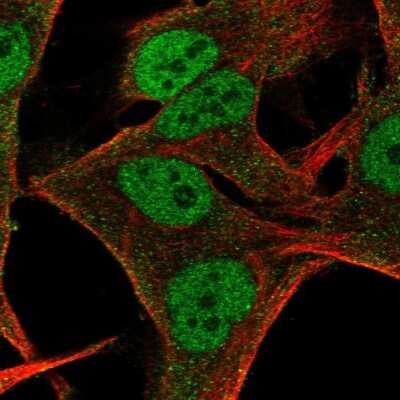 Immunocytochemistry/Immunofluorescence: ITGB1BP3 Antibody [NBP2-55685] - Staining of human cell line SK-MEL-30 shows localization to nucleoplasm & vesicles.