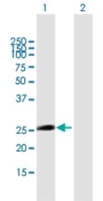 Western Blot: ITGB1BP3 Antibody [H00027231-B01P] - Analysis of ITGB1BP3 expression in transfected 293T cell line by ITGB1BP3 polyclonal antibody.  Lane1:ITGB1BP3 transfected lysate(25.3 KDa). Lane2:Non-transfected lysate.