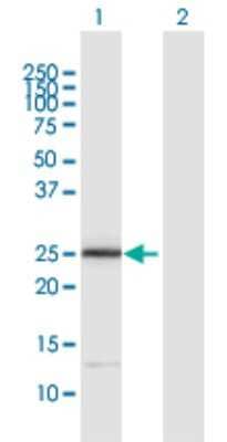 Western Blot: ITGB1BP3 Antibody [H00027231-D01P] - Analysis of ITGB1BP3 expression in transfected 293T cell line by ITGB1BP3 polyclonal antibody.Lane 1: ITGB1BP3 transfected lysate(26.00 KDa).Lane 2: Non-transfected lysate.