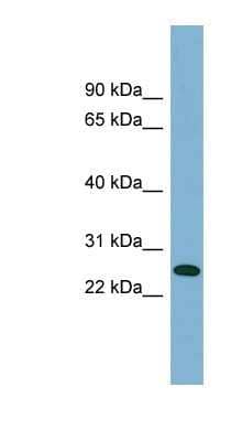 Western Blot: ITGB1BP3 Antibody [NBP1-53033] - Human Thymus lysate, concentration 0.2-1 ug/ml.