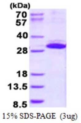 SDS-PAGE Recombinant Human ITGB1BP3 His Protein