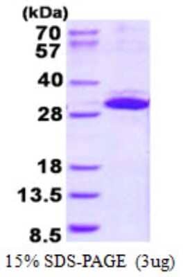 SDS-Page: ITGB1BP3 Protein [NBP2-23286]