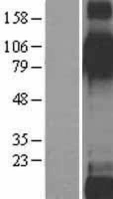 Western Blot Integrin beta 6 Overexpression Lysate