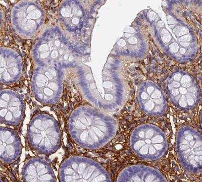 Immunohistochemistry-Paraffin ITIH1 Antibody - BSA Free
