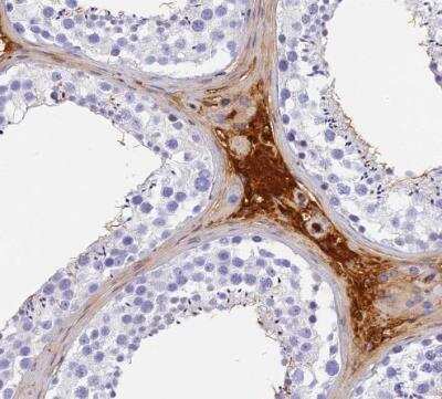 Immunohistochemistry-Paraffin ITIH1 Antibody - BSA Free