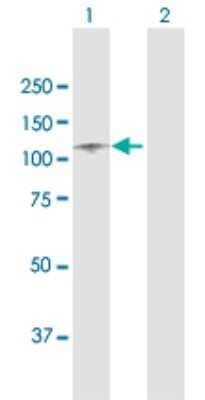 Western Blot: ITIH1 Antibody [H00003697-D01P] - Analysis of ITIH1 expression in transfected 293T cell line by ITIH1 polyclonal antibody.Lane 1: ITIH1 transfected lysate(101.40 KDa).Lane 2: Non-transfected lysate.