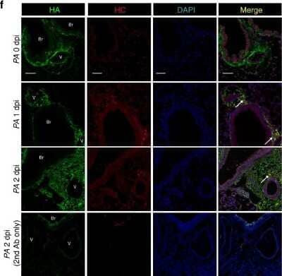 Immunocytochemistry/Immunofluorescence: ITIH2 Antibody [NBP2-31750] - HC-HA formation after LPS or PA injury. Immunofluorescence images of HA and HC localization in formalin-fixed, paraffin-embedded lung sections from control (0 dpi) and PA-injured (1 and 2 dpi) mice, using antibodies against HA binding protein (red) or HC2 (green), and staining for nuclei with DAPI (Blue). Staining control provided in the last row, using secondary antibody only. Note HC-HA co-localization in the peri-broncho (Br)-vascular (V) interstitium (white arrow); scale bar 50 um. Image collected and cropped by CiteAb from the following publication (//respiratory-research.biomedcentral.com/articles/10.1186/s12931-018-0812-1), licensed under a CC-BY license.