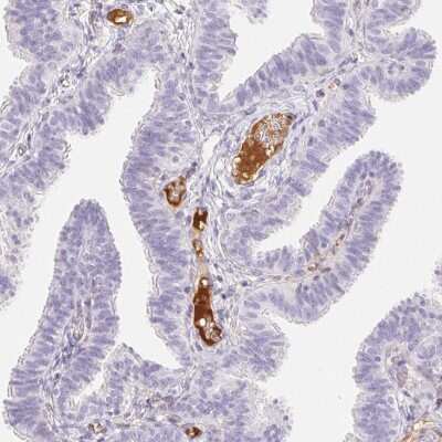 Immunohistochemistry-Paraffin: ITIH2 Antibody [NBP2-31750] - Staining of human fallopian tube shows strong positivity in plasma in blood vessels.