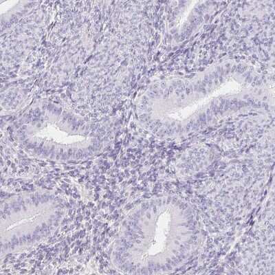 Immunohistochemistry-Paraffin: ITIH2 Antibody [NBP2-31750] - Staining of human endometrium shows no positivity in glandular cells as expected.