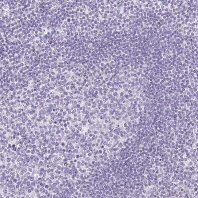 Immunohistochemistry-Paraffin: ITIH2 Antibody [NBP2-31750] - Staining of human tonsil shows no positivity in non-germinal center cells as expected.