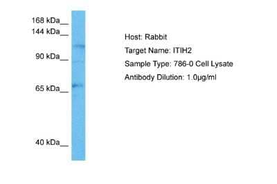 Western Blot: ITIH2 Antibody [NBP2-83087] - Host: Rabbit. Target Name: ITIH2. Sample Tissue: Human 786-0 Whole Cell lysates. Antibody Dilution: 1ug/ml