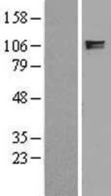 Western Blot: ITIH2 Overexpression Lysate (Adult Normal) [NBL1-12078] Left-Empty vector transfected control cell lysate (HEK293 cell lysate); Right -Over-expression Lysate for ITIH2.