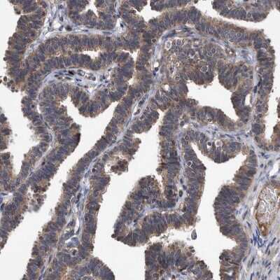 Immunohistochemistry-Paraffin ITIH3 Antibody - BSA Free