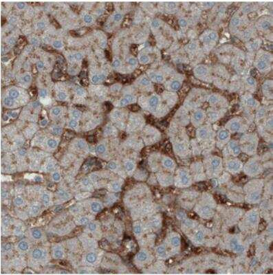 Immunohistochemistry ITIH4 Antibody (CL1858) - BSA Free