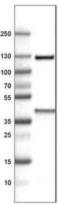 Western Blot: ITIH4 Antibody (CL1858) [NBP2-34492] - Lane 1: Marker  [kDa].  Lane 2: Human liver tissue lysate
