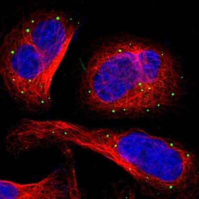 Immunocytochemistry/Immunofluorescence: ITIH4 Antibody [NBP1-81777] - Immunofluorescent staining of human cell line U-2 OS shows localization to vesicles.