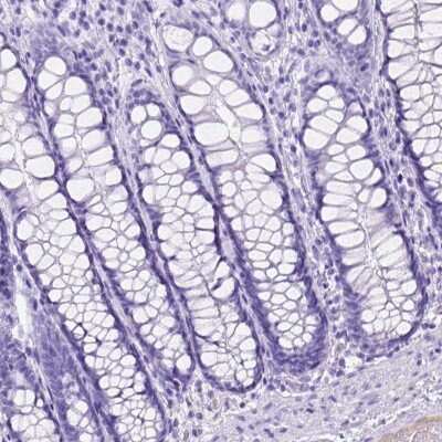 Immunohistochemistry-Paraffin: ITIH4 Antibody [NBP1-81777] - Staining of human colon shows low expression as expected.
