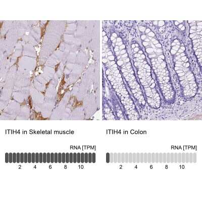 Immunohistochemistry-Paraffin ITIH4 Antibody - BSA Free