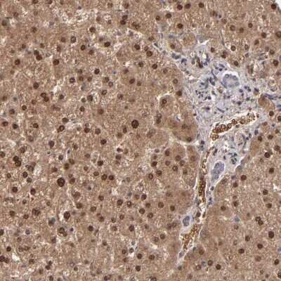 Immunohistochemistry-Paraffin: ITIH4 Antibody [NBP1-81778] - Staining of human liver shows high expression.