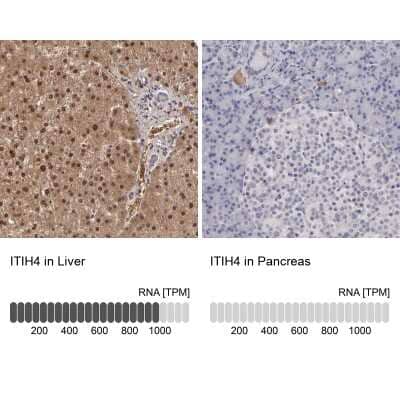 <b>Orthogonal Strategies Validation. </b>Immunohistochemistry-Paraffin: ITIH4 Antibody [NBP1-81778] - Staining in human liver and pancreas tissues using anti-ITIH4 antibody. Corresponding ITIH4 RNA-seq data are presented for the same tissues.