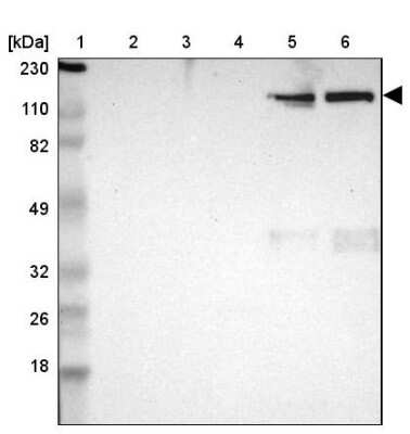 <b>Orthogonal Strategies Validation. </b>Western Blot: ITIH4 Antibody [NBP1-81777] - Lane 1: Marker [kDa] 230, 110, 82, 49, 32, 26, 18Lane 2: Human cell line RT-4Lane 3: Human cell line U-251MG spLane 4: Human plasma (IgG/HSA depleted)Lane 5: Human liver tissueLane 6: Human tonsil tissue