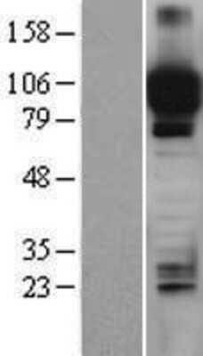 Western Blot ITIH4 Overexpression Lysate