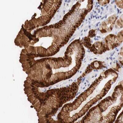 Immunohistochemistry: ITIH5L Antibody [NBP2-34207] - Staining of human stomach shows strong nuclear and cytoplasmic positivity in glandular cells.