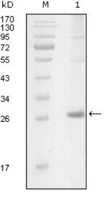 Western Blot: ITK Antibody (5G12C4) [NBP1-28893] - Western blot analysis using ITK mouse mAb against truncated Trx-ITK recombinant protein (1).