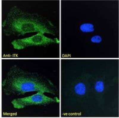 Immunocytochemistry/ Immunofluorescence ITK Antibody