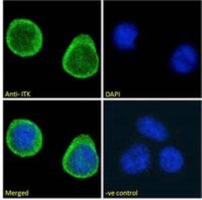 Immunocytochemistry/ Immunofluorescence ITK Antibody