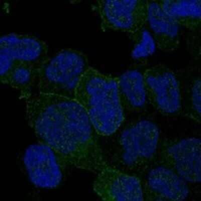 Immunocytochemistry/Immunofluorescence: ITK Antibody [NBP3-17873] - Staining of human cell line JURKAT shows localization to plasma membrane & cytosol.