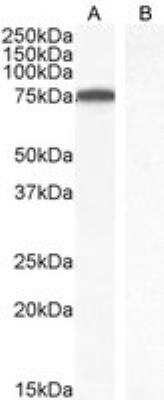 Western Blot ITK Antibody