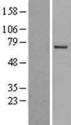 Western Blot: ITK Overexpression Lysate (Adult Normal) [NBL1-12080] Left-Empty vector transfected control cell lysate (HEK293 cell lysate); Right -Over-expression Lysate for ITK.