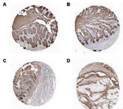 Immunohistochemistry-Paraffin: ITLN1 Antibody (Saly-1) [NBP1-97642] - Staining of endogenous human Omentin 1 in different human tissues (paraffin sections) using MAb to Omentin 1 (Saly-1). Method: Different human normal tissues (A: Rectum; B: Small Intestine; C: Stomach) or cancer tissues (D: Colorectal cancer) were stained with MAb to Omentin 1 (Saly-1) by standard immunohistochemistry.