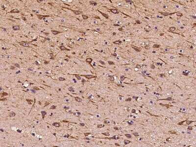 Immunohistochemistry-Paraffin: ITM2A Antibody [NBP2-99451] - Immunochemical staining of human ITM2A in human brain with rabbit polyclonal antibody at 1:1000 dilution, formalin-fixed paraffin embedded sections.