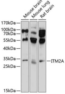 Western Blot: ITM2A Antibody [NBP3-04607] - Analysis of extracts of various cell lines, using ITM2A antibody at 1:1000 dilution. Secondary antibody: HRP Goat Anti-Rabbit IgG (H+L) at 1:10000 dilution. Lysates/proteins: 25ug per lane. Blocking buffer: 3% nonfat dry milk in TBST. Detection:ECL Basic Kit