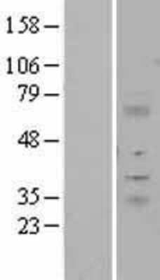 Western Blot: ITM2A Overexpression Lysate (Adult Normal) [NBL1-12081] Left-Empty vector transfected control cell lysate (HEK293 cell lysate); Right -Over-expression Lysate for ITM2A.