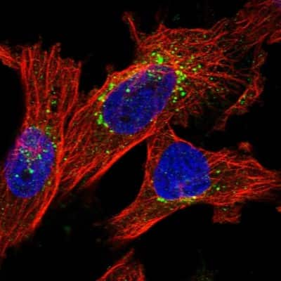 Immunocytochemistry/Immunofluorescence: ITM2B Antibody [NBP1-88354] - Staining of human cell line U-251 MG shows localization to the Golgi apparatus & vesicles. Antibody staining is shown in green.