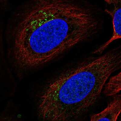 Immunocytochemistry/Immunofluorescence: ITM2B Antibody [NBP2-57975] - Staining of human cell line U-2 OS shows localization to the Golgi apparatus.