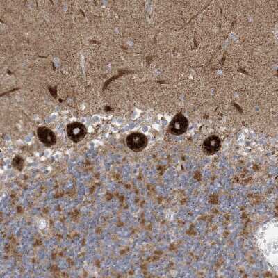 Immunohistochemistry-Paraffin: ITM2B Antibody [NBP1-88354] - Staining of human cerebellum shows strong cytoplasmic positivity in Purkinje cells.