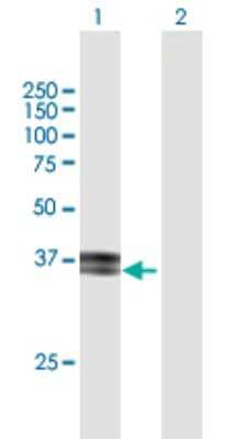 Western Blot: ITM2B Antibody [H00009445-B01P] - Analysis of ITM2B expression in transfected 293T cell line by ITM2B polyclonal antibody.  Lane 1: ITM2B transfected lysate(29.26 KDa). Lane 2: Non-transfected lysate.