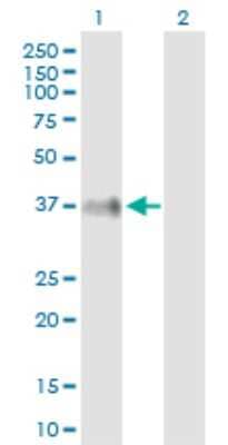Western Blot: ITM2B Antibody [H00009445-B02P] - Analysis of ITM2B expression in transfected 293T cell line by ITM2B polyclonal antibody.  Lane 1: ITM2B transfected lysate(29.26 KDa). Lane 2: Non-transfected lysate.