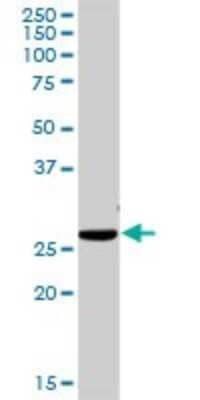 Western Blot: ITM2B Antibody [H00009445-D03P] - Analysis of ITM2B expression in mouse liver.