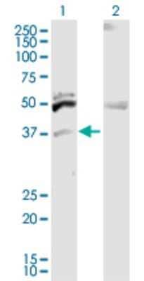 Western Blot: ITM2B Antibody [H00009445-D03P] - Analysis of ITM2B expression in transfected 293T cell line by ITM2B polyclonal antibody.Lane 1: ITM2B transfected lysate(29.26 KDa).Lane 2: Non-transfected lysate.