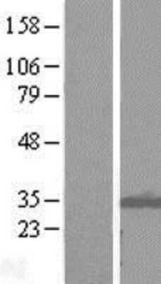 Western Blot: ITM2B Overexpression Lysate (Adult Normal) [NBL1-12082] Left-Empty vector transfected control cell lysate (HEK293 cell lysate); Right -Over-expression Lysate for ITM2B.