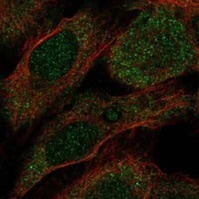 Immunocytochemistry/Immunofluorescence: ITPA Antibody [NBP3-17266] - Staining of human cell line U-2 OS shows localization to cytosol.